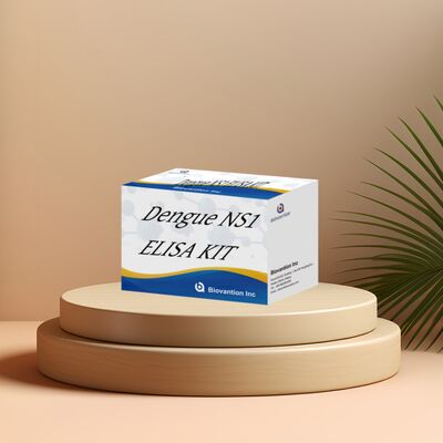 18개월 유효기간 고민성 및 96개의 테스트/ 병원 실험실 진단을 위한 IgM ELISA 테스트 키트