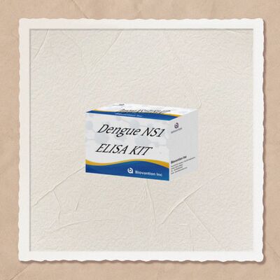 18개월 유효기간 고민성 및 96개의 테스트/ 병원 실험실 진단을 위한 IgM ELISA 테스트 키트