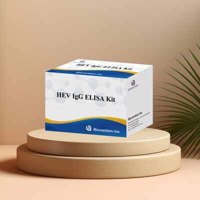 높은 민감성 HEV-IgG ELISA 테스트 키트 96T 크기와 18 개월의 유효 기간으로 간염 E 진단