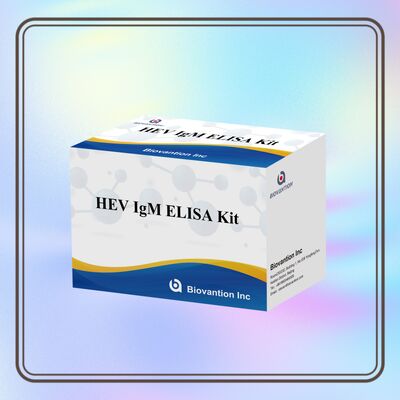정확한 진단을 위한 96T 사이즈 및 2-3시간 검사 시간의 고감도 HEV IgM ELISA 검사 키트