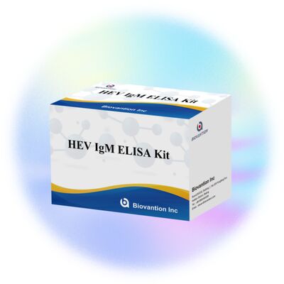 정확한 진단을 위한 96T 사이즈 및 2-3시간 검사 시간의 고감도 HEV IgM ELISA 검사 키트