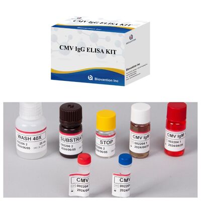 96T CMV ELISA 테스트 키트 (색상 발현 및 샌드위치 방법) - 거대세포바이러스 항체용