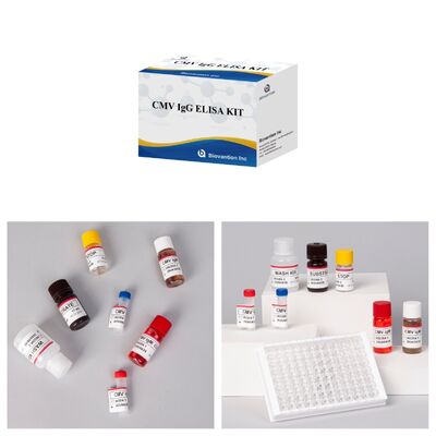96T CMV ELISA 테스트 키트 (색상 발현 및 샌드위치 방법) - 거대세포바이러스 항체용