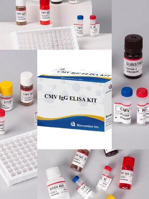 실험실 또는 병원 고정도 CMV IgG Elisa 테스트 키트