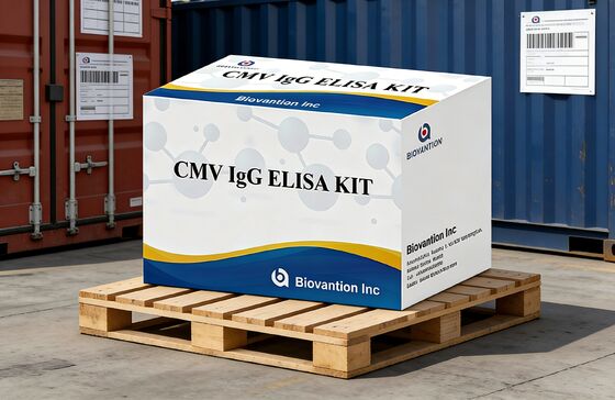 실험실 또는 병원 고정도 CMV IgG Elisa 테스트 키트