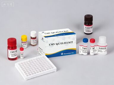 실험실 또는 병원 고정도 CMV IgG Elisa 테스트 키트