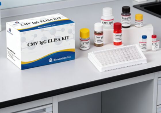 실험실 또는 병원 고정도 CMV IgG Elisa 테스트 키트
