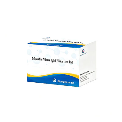 홍역 바이러스 IgM ELISA 테스트 키트 96T 조기 급성 감염 감지
