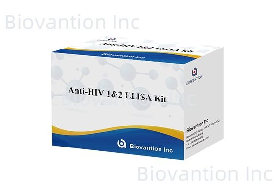 HIV 1/2 ELISA 테스트 키트 96T 인간 면역 결핍 바이러스 항체 검출